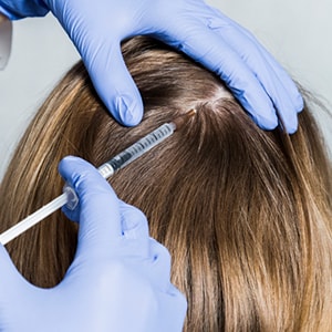 درمان ریزش مو با پی آر پیPRP
